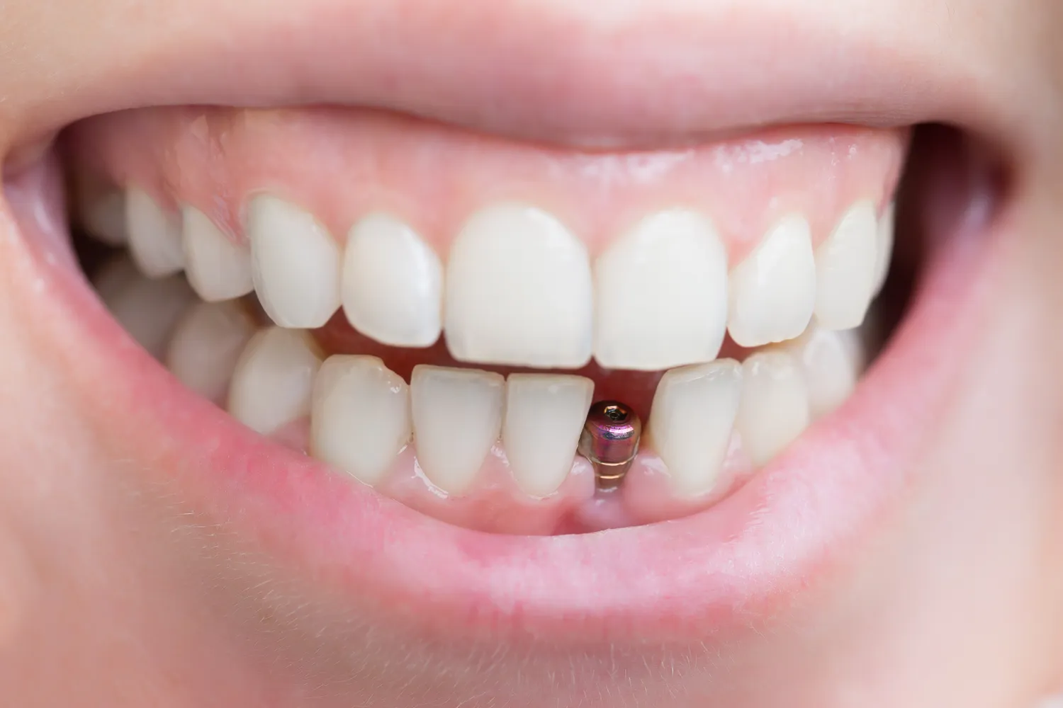 Pierwsza wizyta u dentysty